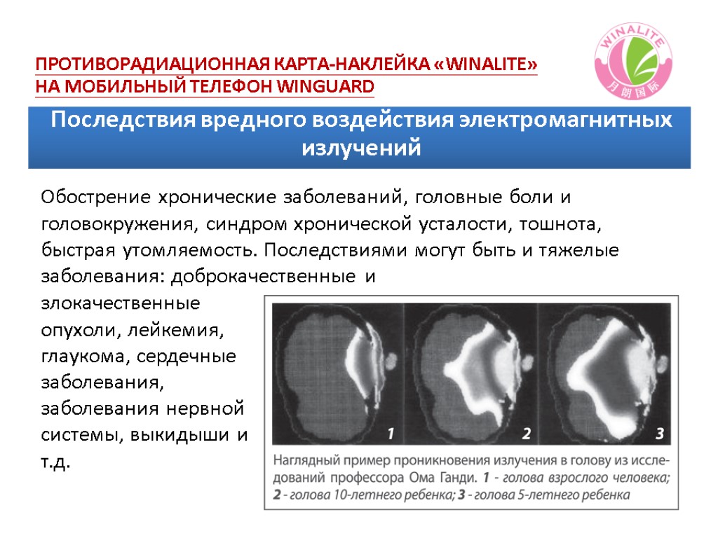 Последствия вредного воздействия электромагнитных излучений Обострение хронические заболеваний, головные боли и головокружения, синдром хронической